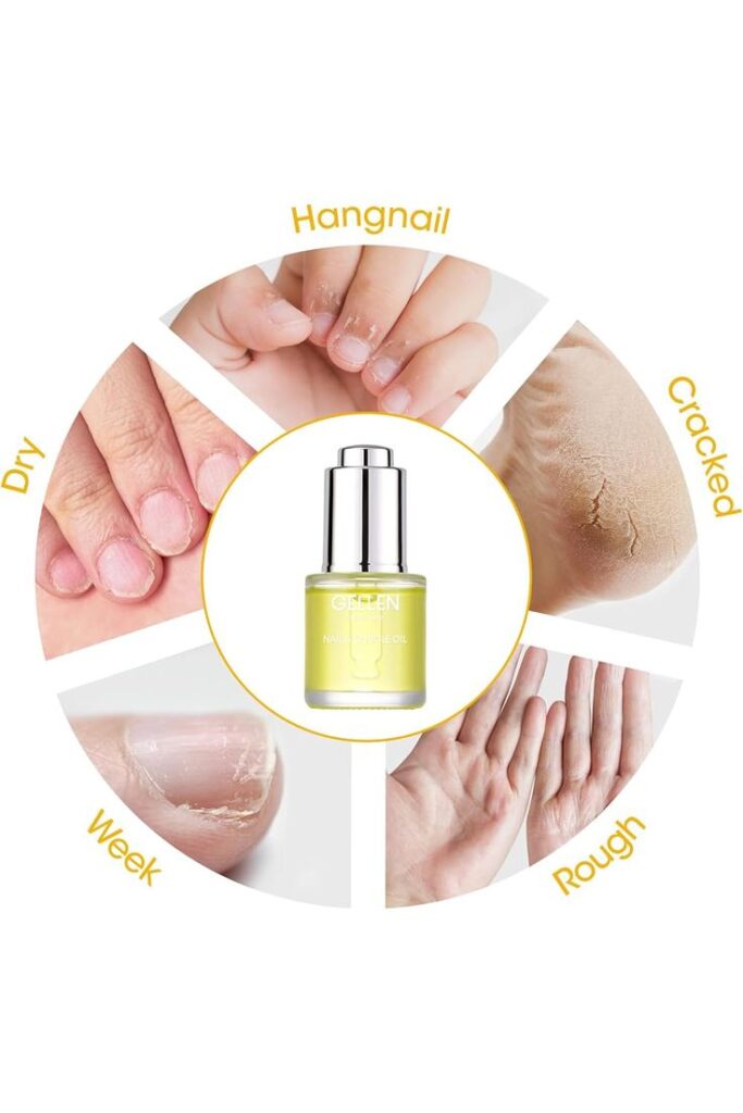 Nail Care Mistakes to Avoid